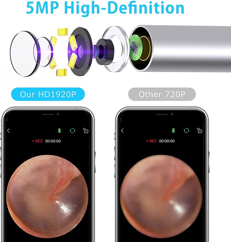 VITCOCO منظار الأذن إزالة الشمع 3.0 مللي متر رقيقة جدا منظار الأذن مع 5MP HD اللاسلكية الأذن منظار الأذن المحمولة البصرية