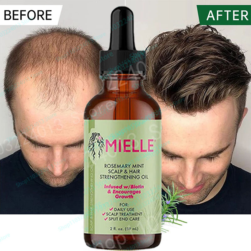 Mielle minyak rambut Mint Rosemary untuk perawatan rambut kulit kepala & penguat rambut meningkatkan keseimbangan ujung pelembut perawatan rambut kulit kepala kering