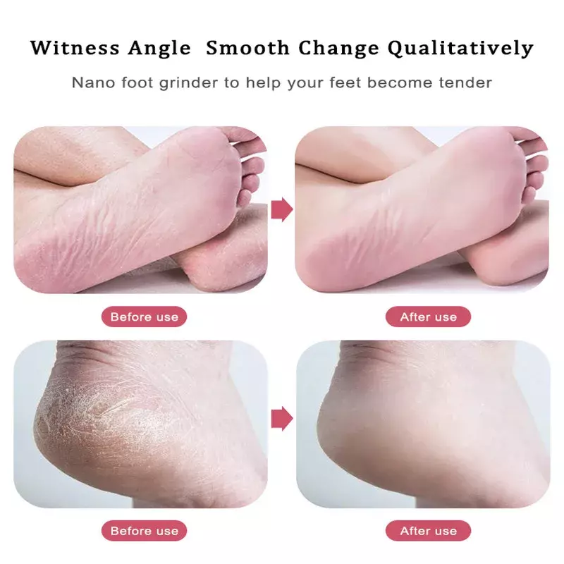 Nano Glass Foot File Rasp Foot Scrubber Callus Dead Skin Remover Foot Grinder Grinding Stone Women Men Feet Care Pedicure Tools