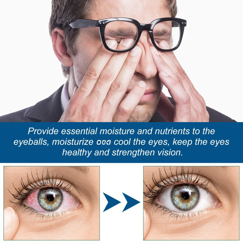 Presbyopia Eye Drops Restore Eyesight Relieve Discomfort Dry Itchy Redness Improve Blurred Vision Fatigue Prevent Infection Care