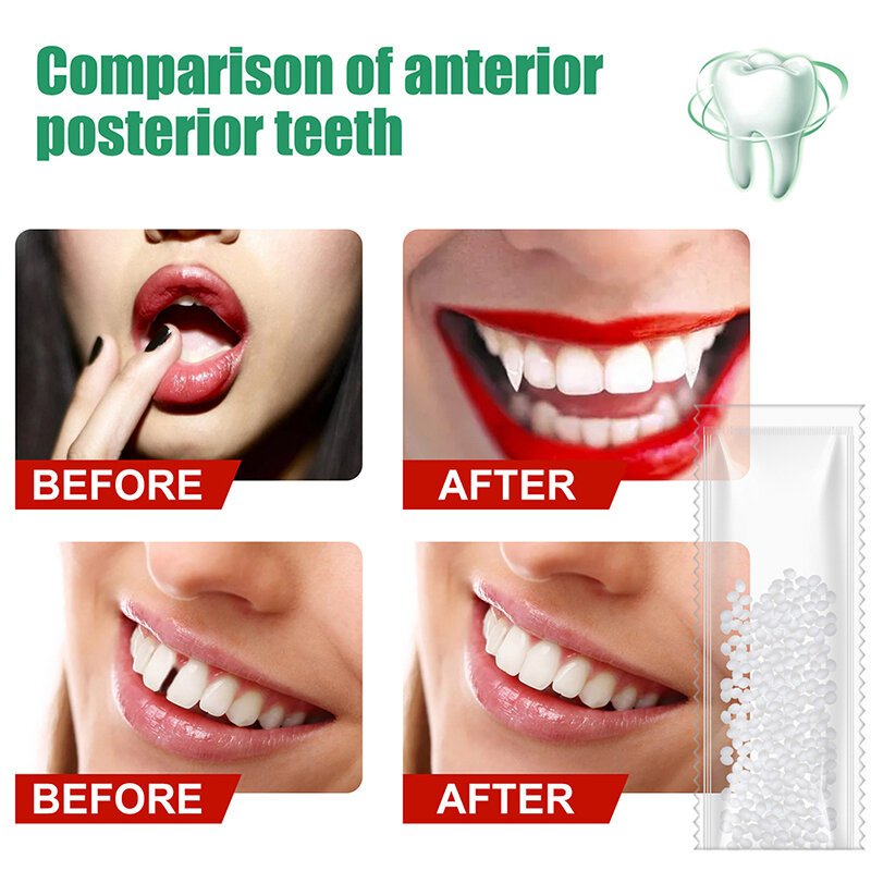 Juego de reparación temporal de dientes, pegamento sólido para dentaduras postizas, productos para dentistas, 10g, alta calidad