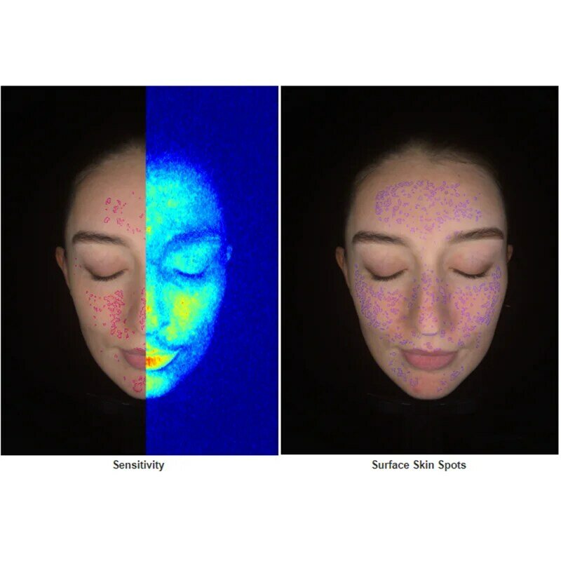 A pele facial detecta a máquina do analisador, salão beleza