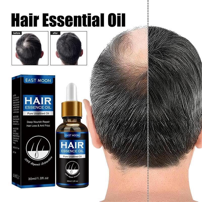 Aceite para el crecimiento del cabello, reparación de la pérdida de cabello posparto heredada, seborreico folículo, reparación rápida y efectiva de la calvicie