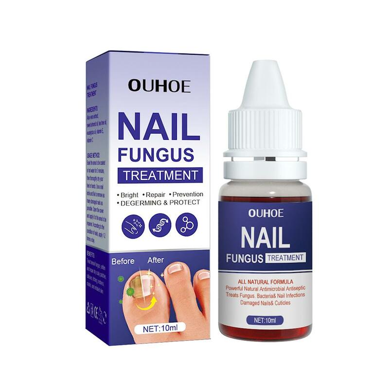 Fungus Nails Treatment For Fingernails Toenails Repair Onychomycosis Paronychia Anti Infection Toe Nail Fungal Removal Liqu I7D6