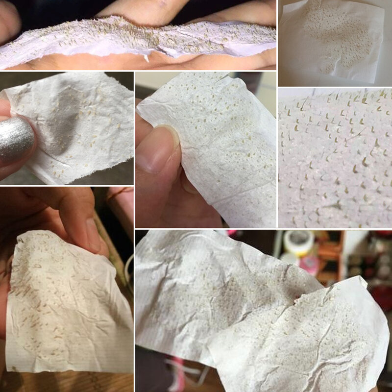 Lanbena Efficiënte Mee-Eter Verwijderaar Neusmasker Poriënstrook Zwart Masker Peeling Acne Behandeling Zwart Diepe Reiniging Huidverzorging Korea