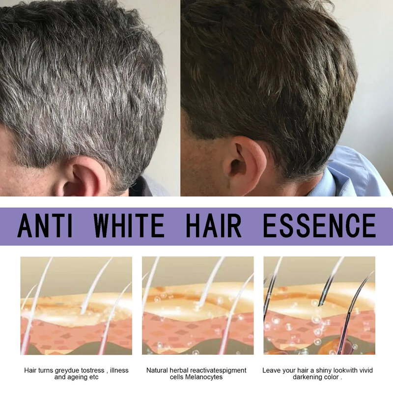 Serum perawatan rambut abu-abu produk nutrisi perbaikan warna alami putih ke hitm Perawatan Rambut rontok Pria Wanita