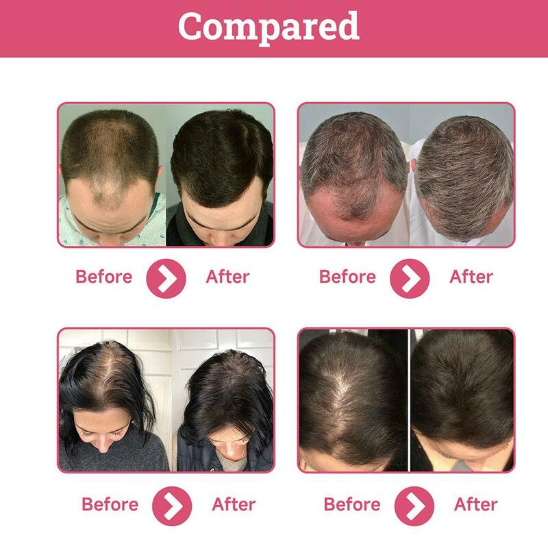 59ml ätherisches Öl Kopfhaut Haars tärkung Enden Split Öl Öl trockenes Haar Reparatur pflegende Pflege k8m3