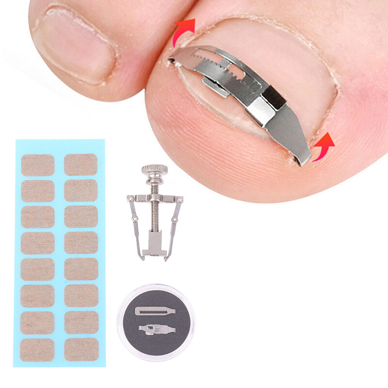 Outils de pédicure professionnels pour les ongles incarnés, traitement des ongles en gélatine Parker, soin des pieds, 1 ensemble