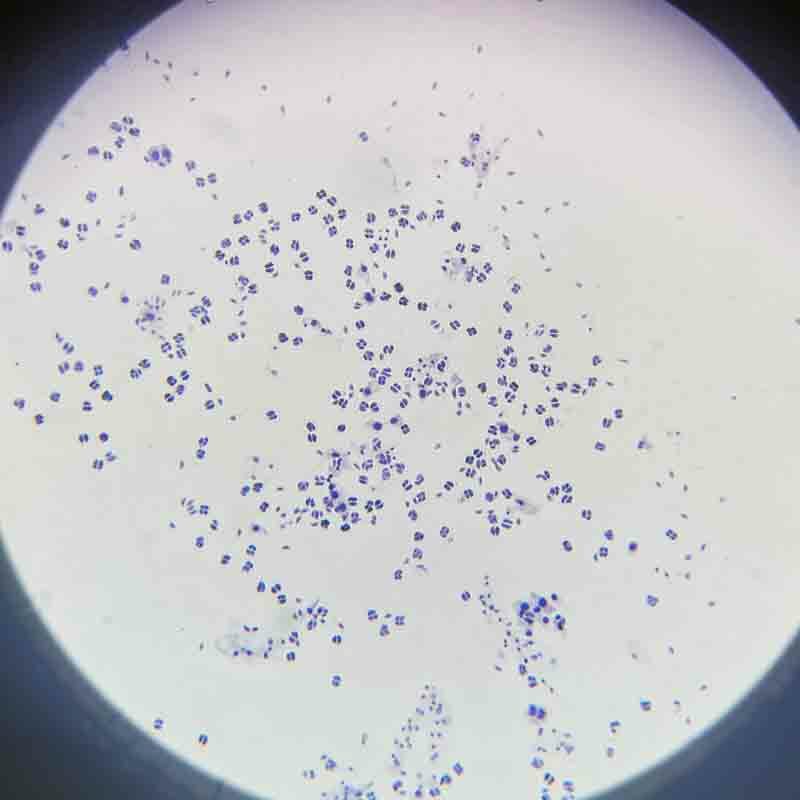 12pcs Anther Meiosis bawang 5pcs ujung akar bawang Mitosis disiapkan kaca slide mikroskop spesimen