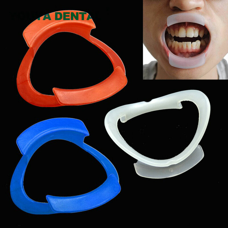Retractor Oral Ortodôntico em O-Shape, Abridor de Boca, Expansores Intraorais das Bochechas dos Lábios, Higiene Oral, 1Pc