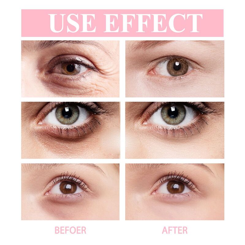 Retinol Eye Cream Anti-Wrinkle Eye Cream Reduce Dark Circles Puffiness Tighten Moisturizes Brightening Eye Area Korean Skin Care