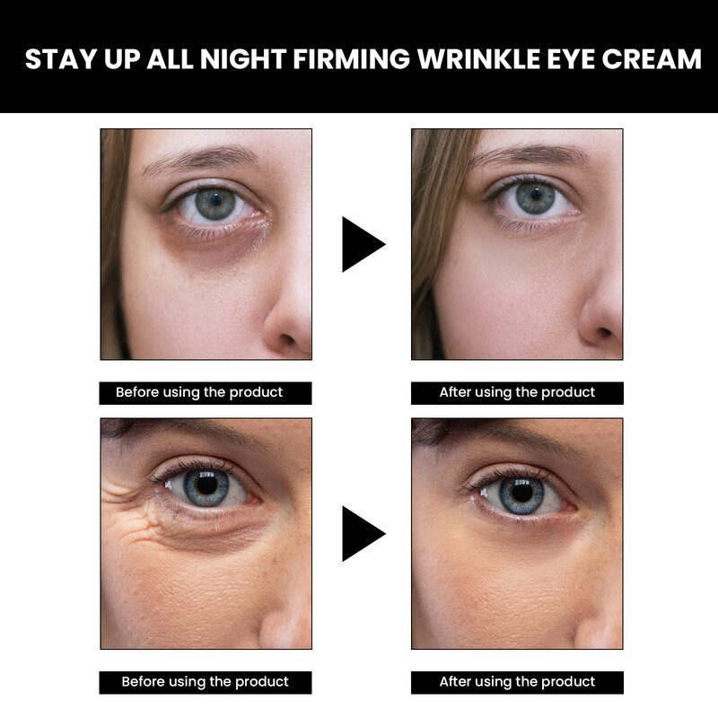 Eye Anti Wrinkles Cream Fading Fine Lines Age Moisturizing Lifting Firming Remove Bags Puffiness Dark Circles Removal Eyes Cream