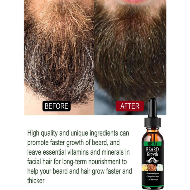 Óleo essencial de crescimento do cabelo barba para homens, produto anti perda de cabelo, óleo natural de rebrota bigode, nutritivo cuidado barba rolo, novo