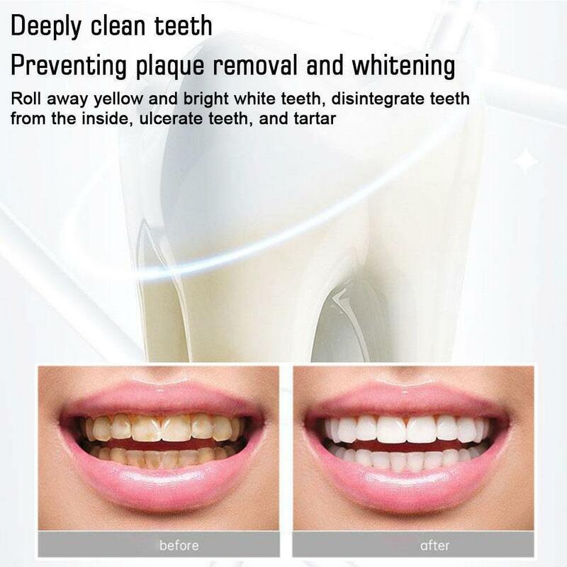 Probiótico Whitening Creme dental, Higiene Oral, Placa de Limpeza Removedor de Manchas, Hálito Fresco, Dental Health Care, SP-4, 100g