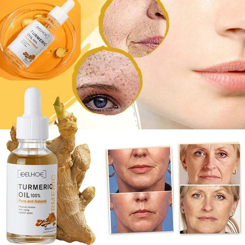 10X olio di curcuma pelle per schiarire l'acne toppe scure Acne Bright Skin correttore di macchie scure Anti invecchiamento viso sbiancante siero cura