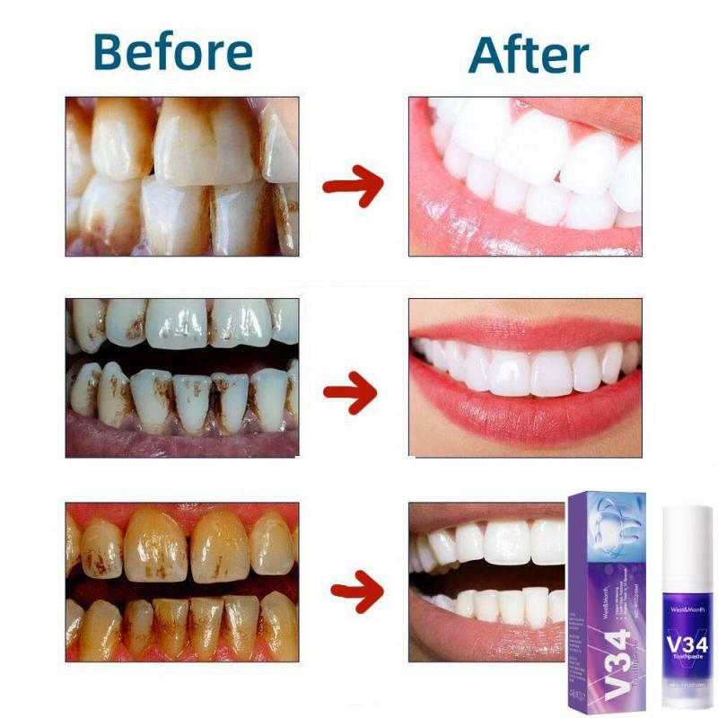 V34 Mousse detergente per denti viola pressa in bottiglia dentifricio rinfresca l'alito sbianca rimozione delle macchie dei denti pulizia dentale 30ml
