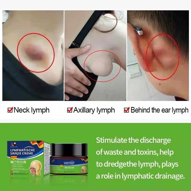Lymfatische Detox Crème Oksel Nek Borst Anti-Zwelling Behandeling Zalf Lymfeklieren Drainage Zorg Patch Duitsland Formule