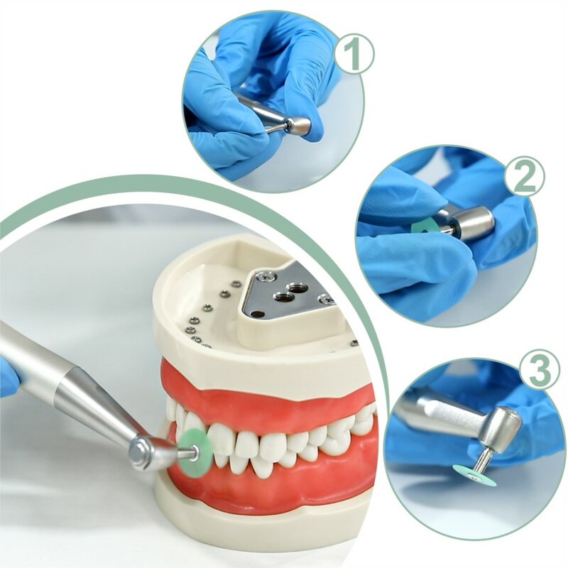 Azdent-Discos de pulido Dental, mandril de contorneado de reducción gruesa, consumibles dentales a rayas, no se puede utilizar en autoclave