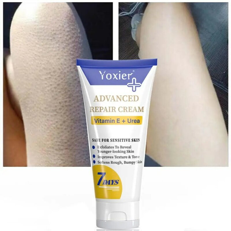 1/2/3/5X  Moisturizing BodyCream Treatment Keratosis Pilaris Improves E Bumpy Rough Whitening Texture Skin Softens Vitamin Tone