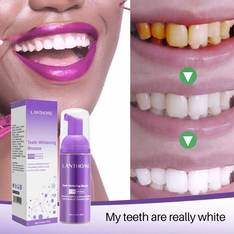 Creme dental Mousse V34 para limpeza oral, Creme dental clareador, Amarelo Removendo Manchas Dentes, Cuidado de Higiene Oral