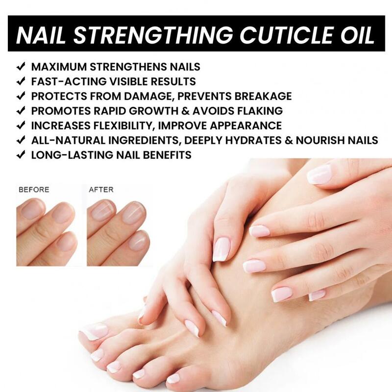 Onychomycosis Nail Treatment Fast-acting 15ml Nail Strengthening Cuticle Oil Repair Damaged Nails Moisturize Cuticles Enhance