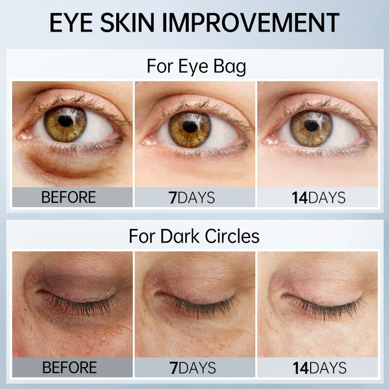 Ácido hialurônico Eye Cream, peptídeo, círculos escuros removedor, rugas removedor, cuidados com a pele, hidratante, reduz linhas finas, anti rugas