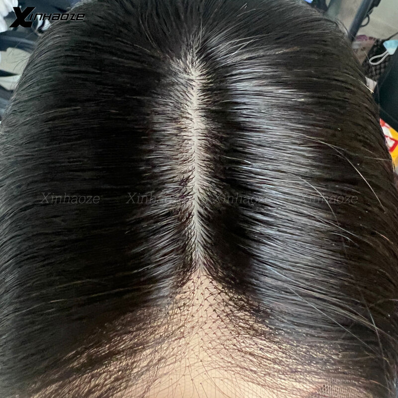 5x5 Silk Basis Verschluss Silikon Silk Top Menschliches Haar Spitze Verschluss Remy Menschliches Haar Extensions mit Baby Haar freies Mittleren Teil