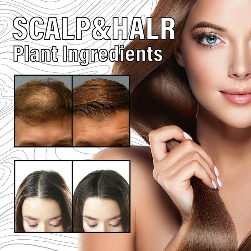 Óleo essencial de cabelo de crescimento rápido para homens e mulheres, cuidados capilares, prevenção de perda de cabelo, tratamento do couro cabeludo, produtos biotina, H4O8, 30ml