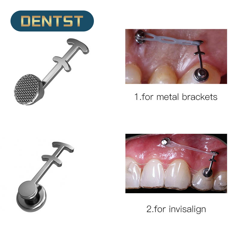 10pcs Dental Orthodontic Crimpable Hook Curved Hook Bondable Buccal Tube For Brackets Braces Archwires