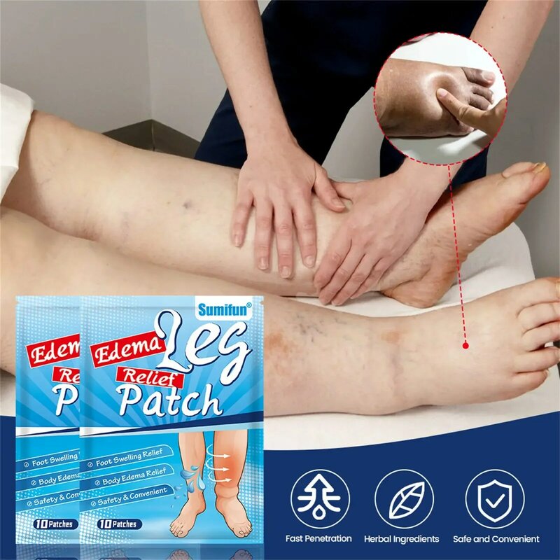 30pcs Leg Swelling Pain Relief Patch Vasculitis Phlebitis Spiderleg Medical Edema Patches Leg Feet Treatment Health Care Sticker