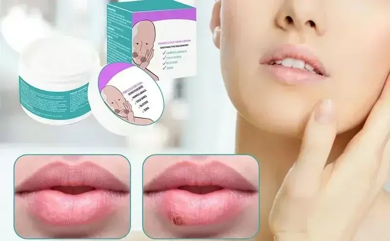Cheilitis Cream Reparatie Lippenbalsem Reparatie Lippenbalsem Huid Externe Crème Natuurlijke Plantenextracten Verzachtende Honing Lip Cream