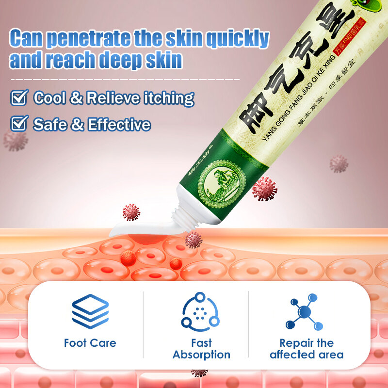 Beribéri-creme anti-fúngico para o pé, anti-psoríase, anti-coceira, pomada para o tratamento da pele, o que é bom para o tratamento da pele, a941, 2pcs