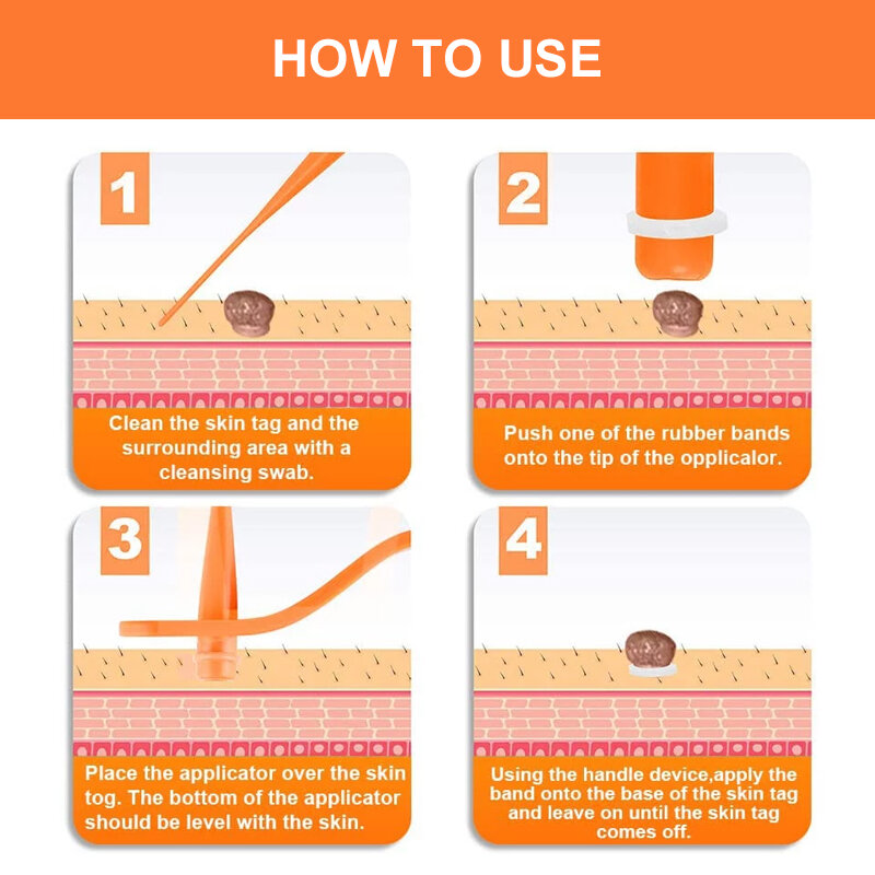 2 In 1 Skin Tag Removal ชุด Mini Mole Wart เครื่องมือผิว: Killer Facial Care Mole Wart Remover ทำความสะอาด Swab Face Care เครื่องมือ