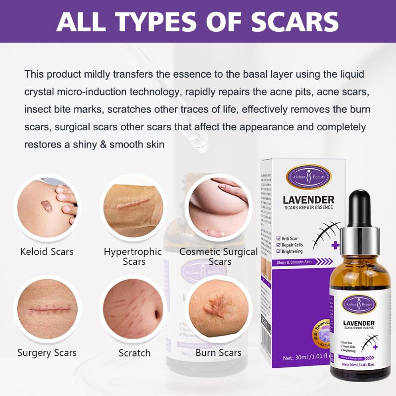 Scar Repair Serum Scar Treatment Surgical Scars Burns Skin Trauma Acne Imprints Stretch Marks Fade Pigmentation Skin Care 30ml