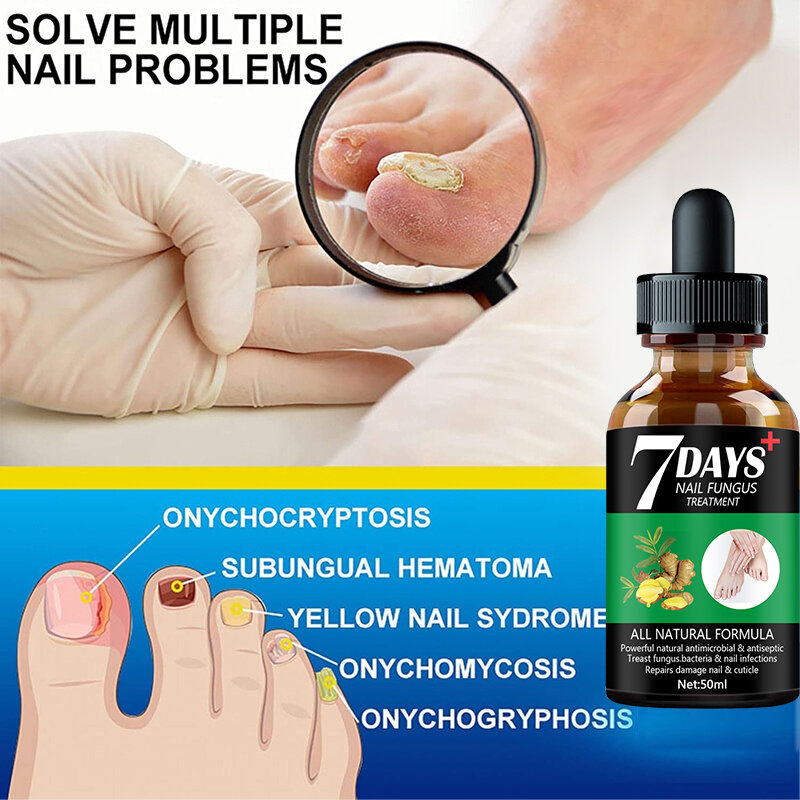 Sérum para el cuidado de los pies, Gel antiinfección para eliminar hongos en las uñas, onicomicosis, 7 días de reparación, 50ML