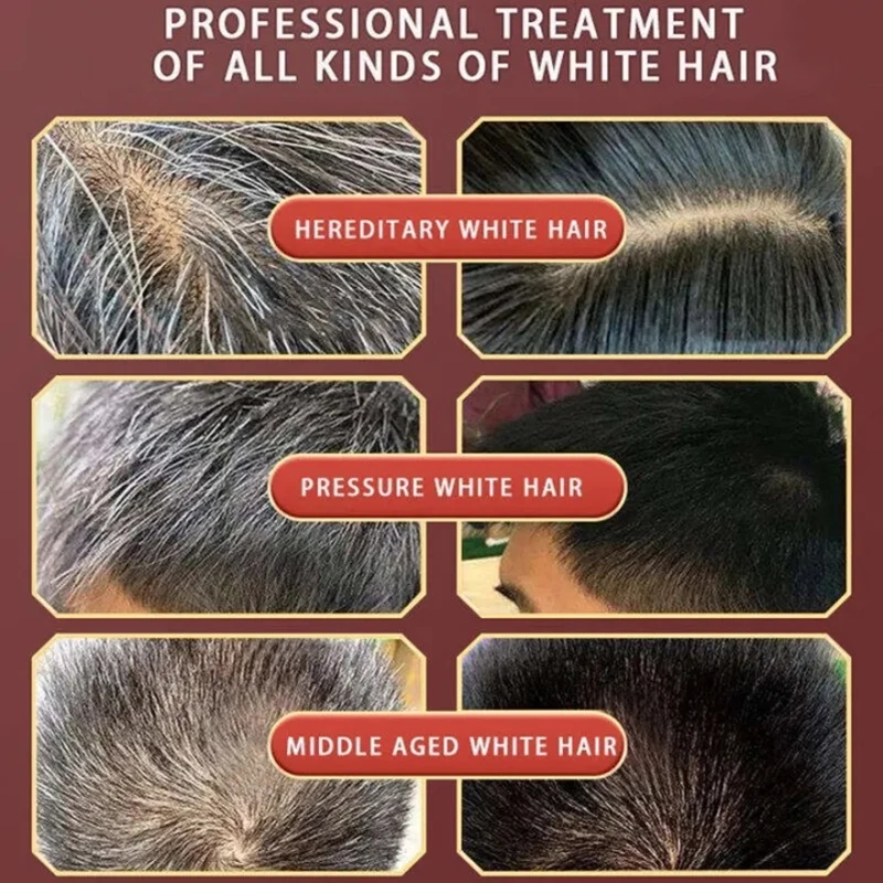 Shampoo de tintura natural de ervas naturais, 5 minutos, muda a cor do cabelo, reparo não irritante, cinza e branco, cuidados com os cabelos para homens e mulheres