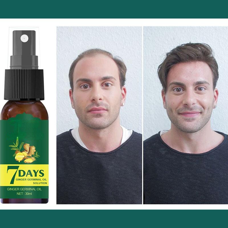 7 dni imbir wzrost włosów Spray oleju mężczyźni kobiety szybko promować włosy rosną grubsze anty utrata włosów leczenie skóry głowy odżywiają włosy