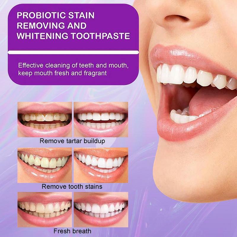 Dentifricio bianco sbiancante schiarente per denti e smacchiatore dentifricio schiarente per la prevenzione della cavità orale per adulti 4.2OZ