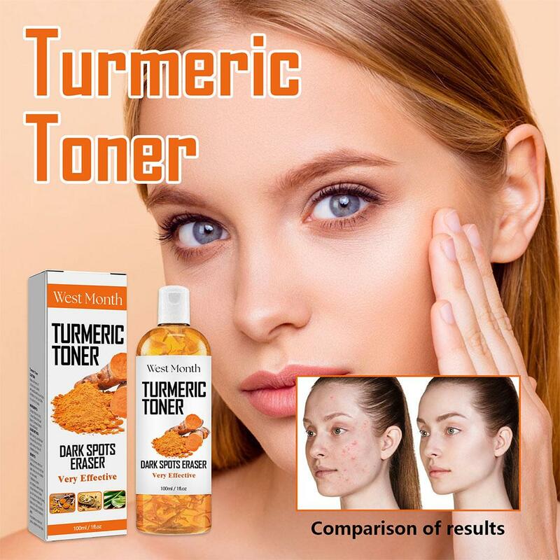 2 pezzi di Toner alla curcuma 200ml Toner correttore di macchie scure per le donne Toner idratante viso illumina il tono della pelle Formula naturale