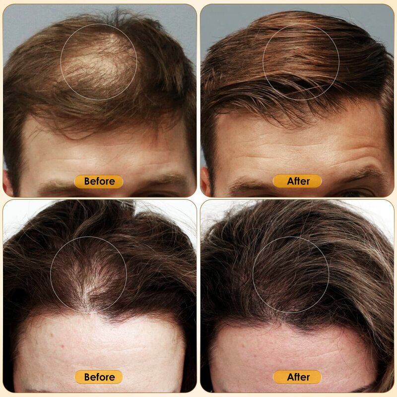 Spray per capelli di riso nero Spray per capelli rinforzante condizionante levigante per la crescita dei capelli previene il diradamento della riparazione dei capelli secchi