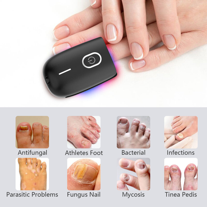 Nail Repair Fingernail Device Fast Repair Nails Fungus Onychomycosis For Fingernails Toenails Paronychia Anti Infection Toe Nail