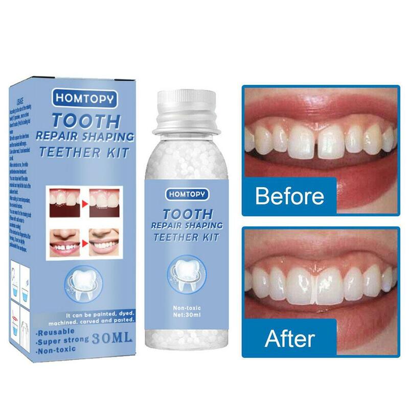 Teeth Repair Glue 30ml for Fixing The Missing and Broken Tooth Replacements Temporary Moldable False Teeth Dental Repair Ki M4N8