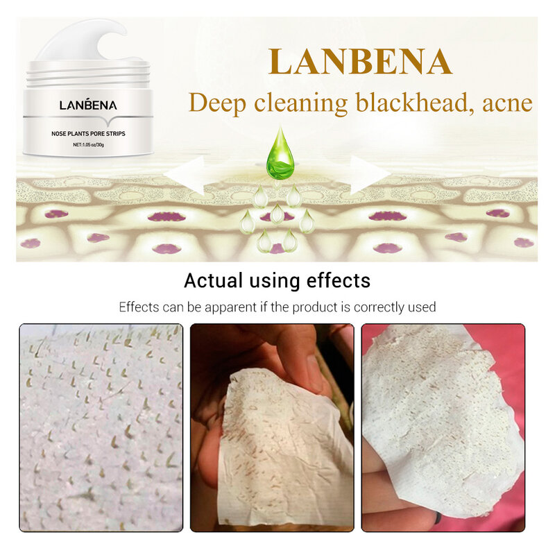 LANBENA Blackhead Remover Nose Mask Pore Strip Black Mask Peeling Acne Treatment Deep Cleansing Face Mask Oil Control Skin Care