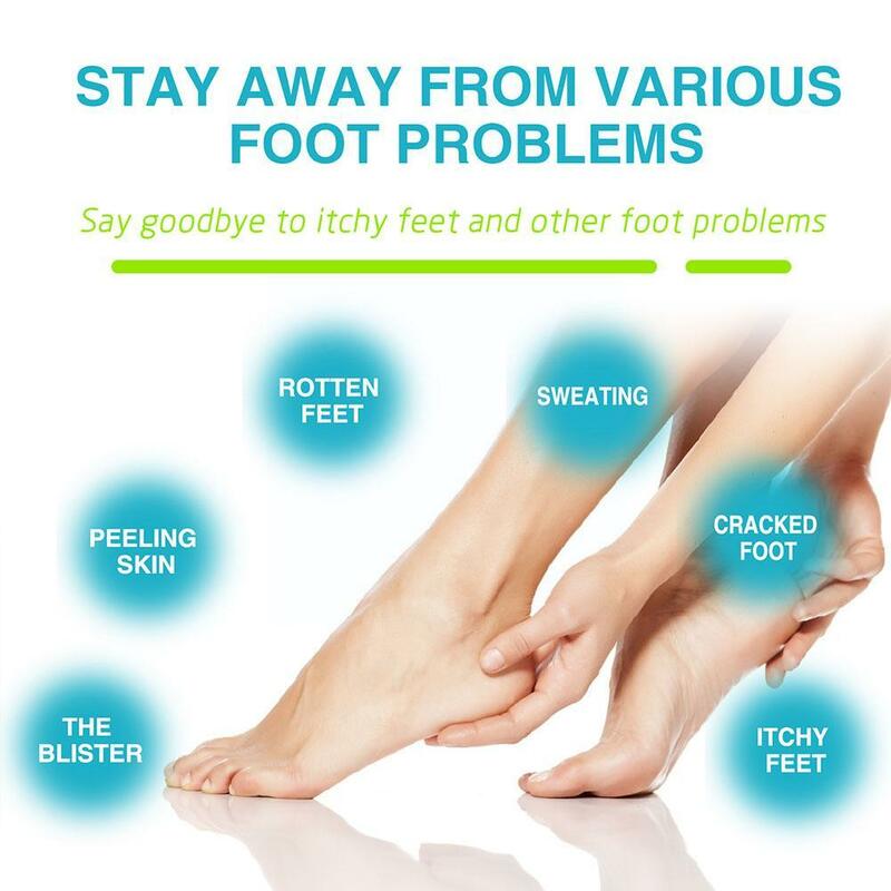 สเปรย์ดับกลิ่นเท้า30มล. สเปรย์กำจัดกลิ่นเท้าสำหรับผิวเท้าให้ความชุ่มชื้นป้องกันการดับกลิ่นเล็บซ่อมแซม U1Z3สด