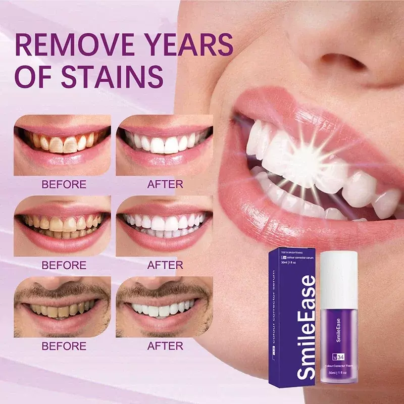 SmileEASE-pasta de dientes blanqueadora V34 púrpura, elimina manchas, Reduce el color amarillo, cuidado de las encías dentales, aliento fresco, ilumina los dientes, 30ml