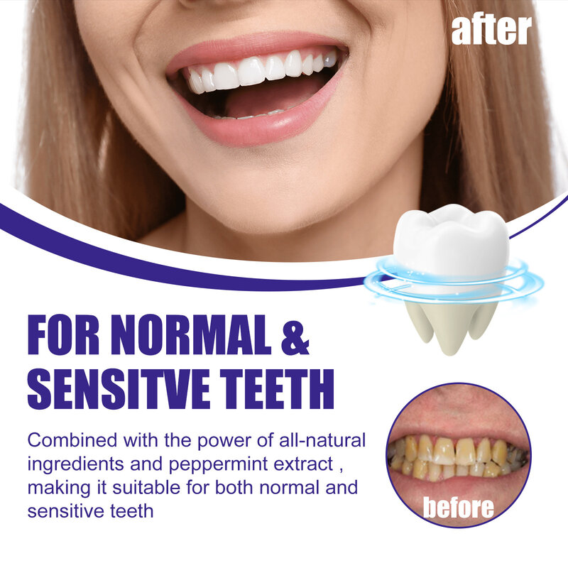 Порошок для отбеливания зубов, улучшение зубного налета, сатиновое удаление, защита десен, гигиена полости рта, дыхание, свежий порошок для чистки зубов