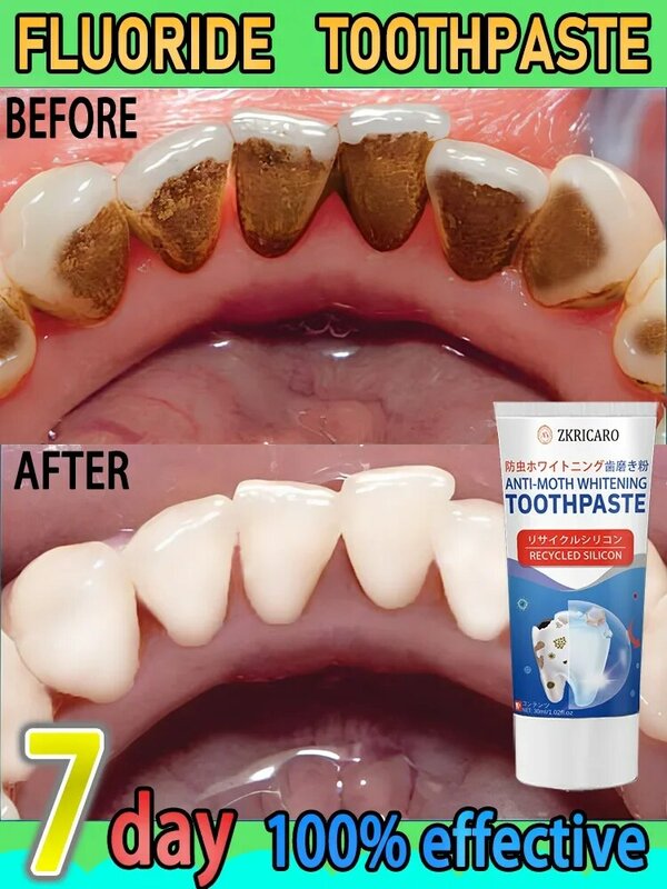 Best Verkopende Tandpasta Met Hoge Fluoridegomverzorging Met Verse Fruitsmaak Om Tanden Te Beschermen