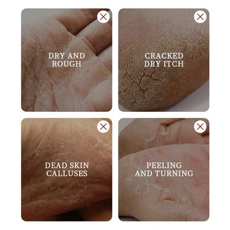 Krem na sucha popękana stopy pięty dłonie pielęgnacja ciała głęboko nawilżający kalus martwa skóra usunąć pielęgnację stóp