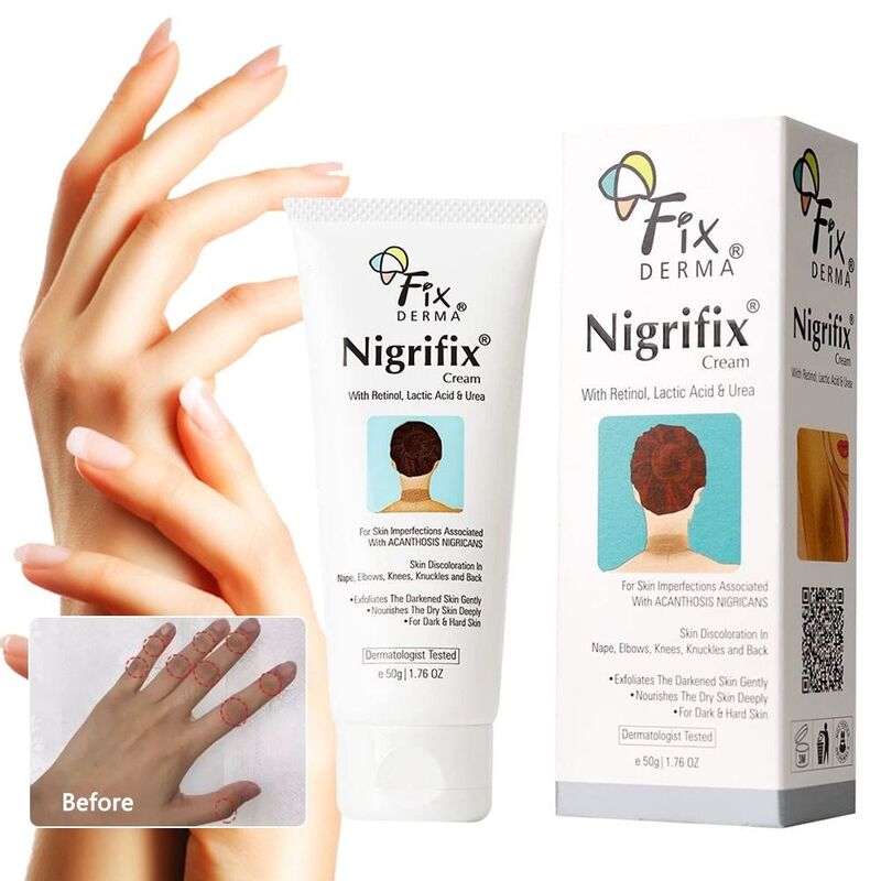 Treatment Acanthosis Nigricans Therapy Cream Dark Spot Corrector Cream Nigricans Therapy Cream Fixderma Nigrifix Cream