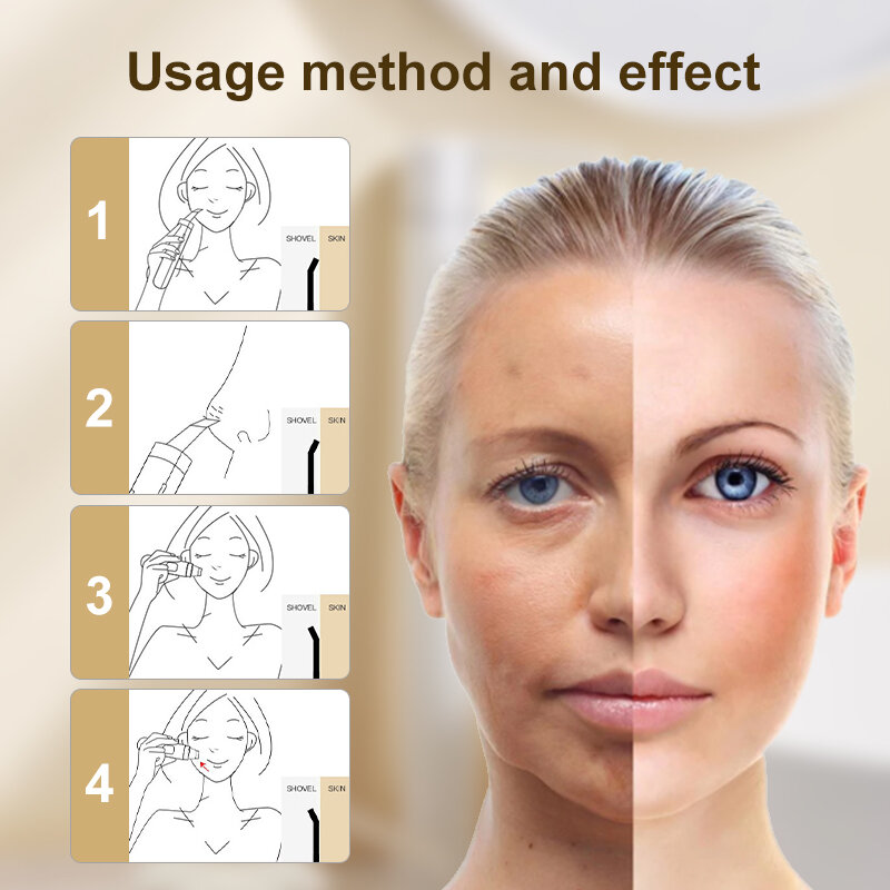 Dinsaver-cepillo eléctrico ultrasónico para limpieza Facial, limpiador Facial, eliminador de espinillas, herramientas para el cuidado de la piel